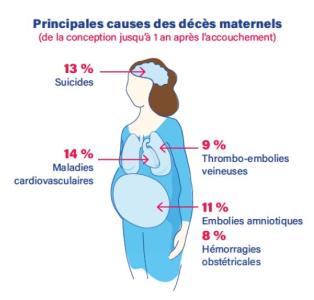Infographie illustration CP_Mortalité Maternelle_06012021