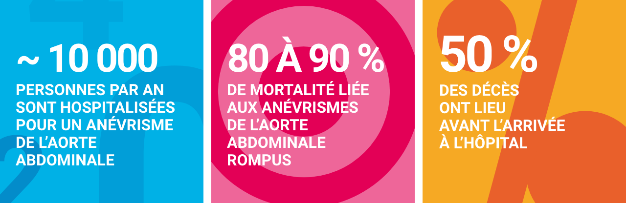 Infographie concernant les anévrismes de l’aorte abdominale